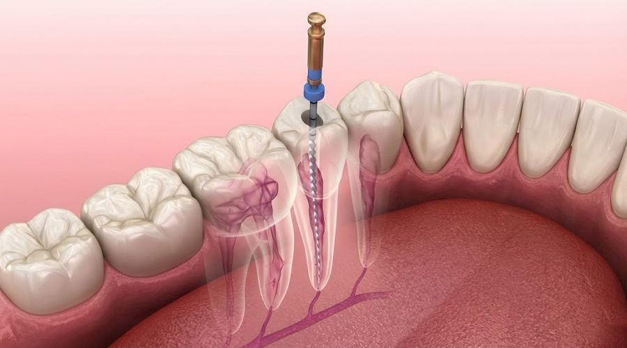 Happy person with braces